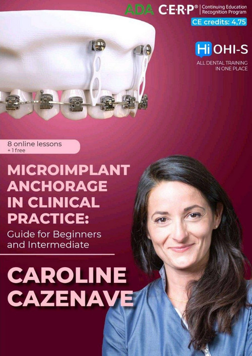 Microimplant Anchorage in Clinical Practice: Guide for Beginners and Intermediate 1 Microimplant Anchorage in Clinical Practice: Guide for Beginners and Intermediate