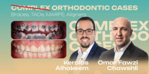 Complex Orthodontic Cases. Braces, TADs, MARPE, Aligners