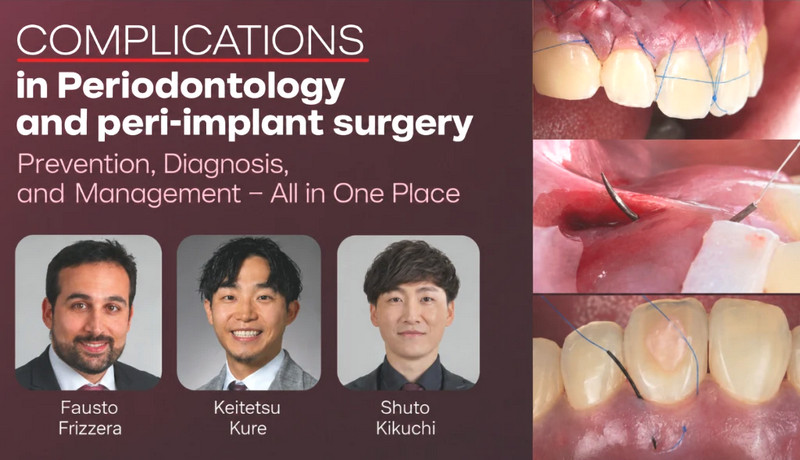 Complications in Periodontology and Peri-implant Surgery Prevention, Diagnosis, and Management – All in One Place 1 Complications in Periodontology and Peri-implant Surgery Prevention, Diagnosis, and Management – All in One Place