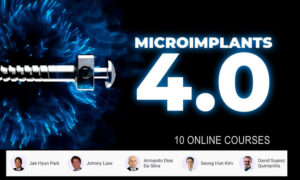 Microimplants 4.0