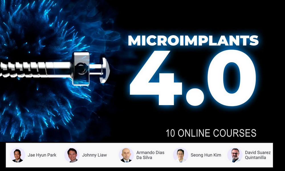 Microimplants 4.0 1 Microimplants 4.0